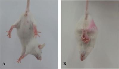 Involvement of <mark class="highlighted">CYP2E1</mark> in the Course of Brain Edema Induced by Subacute Poisoning With 1,2-Dichloroethane in Mice